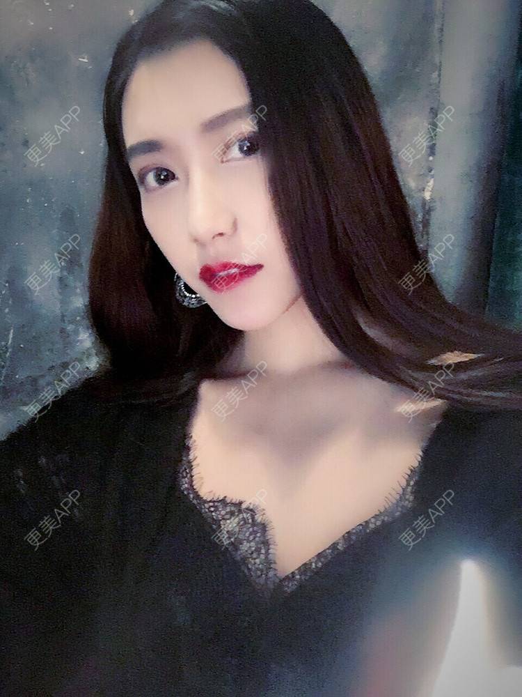 更美 - 更美用户ZXEbAlpKTV的双下巴溶脂经验 | 双下巴溶脂