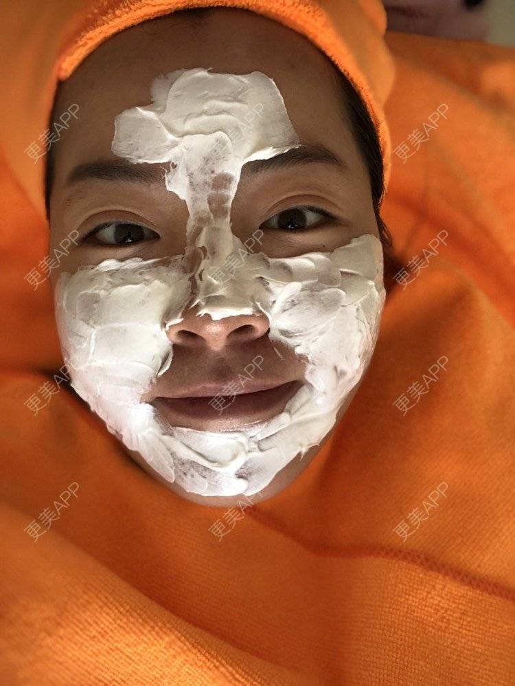 更美 - Shirley-9的点阵激光经验 | 苏州 | 点阵激光