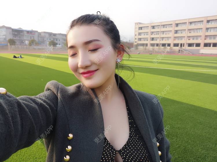 更美 - 更美用户vUOf7IO6ke的玻尿酸卧蚕经验 | 玻尿酸卧蚕