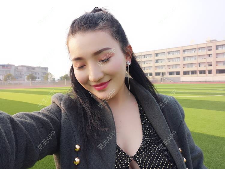 更美 - 更美用户vUOf7IO6ke的玻尿酸卧蚕经验 | 玻尿酸卧蚕