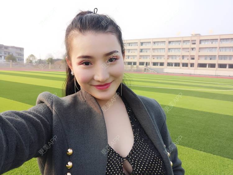 更美 - 更美用户vUOf7IO6ke的玻尿酸卧蚕经验 | 玻尿酸卧蚕