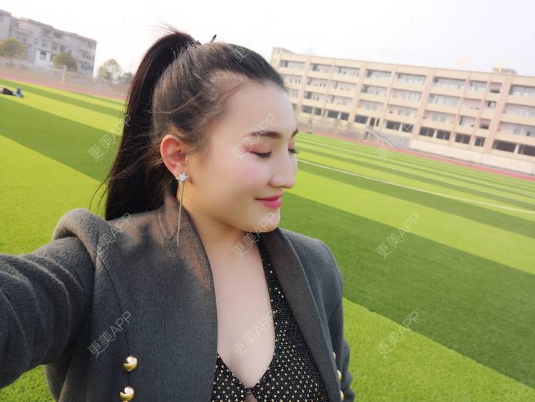 更美 - 更美用户vUOf7IO6ke的玻尿酸卧蚕经验 | 玻尿酸卧蚕