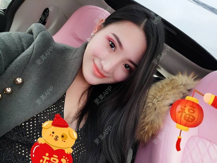 更美 - 更美用户vUOf7IO6ke的玻尿酸卧蚕经验 | 玻尿酸卧蚕