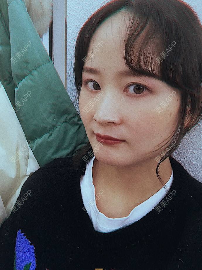 更美 - 更美用户KAxQDlSHWk的全瓷牙经验 | 全瓷牙 | 深圳