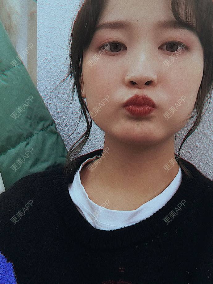 更美 - 更美用户KAxQDlSHWk的全瓷牙经验 | 全瓷牙 | 深圳