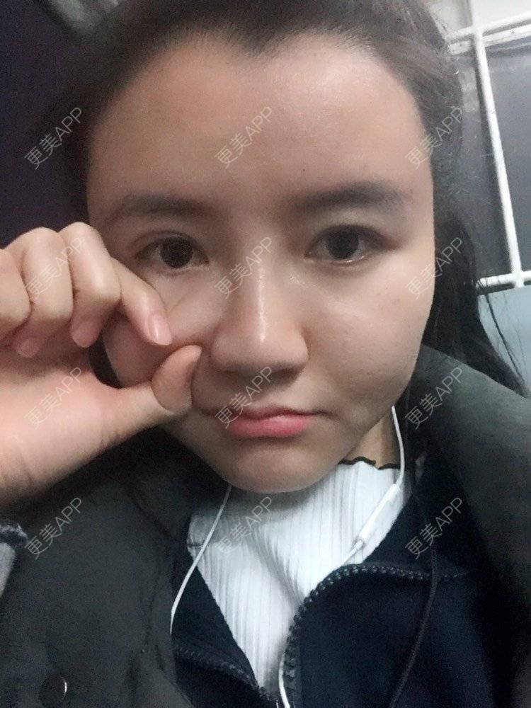 更美 - fhrhjtjth的近视矫正经验 | 深圳 | 近视矫正