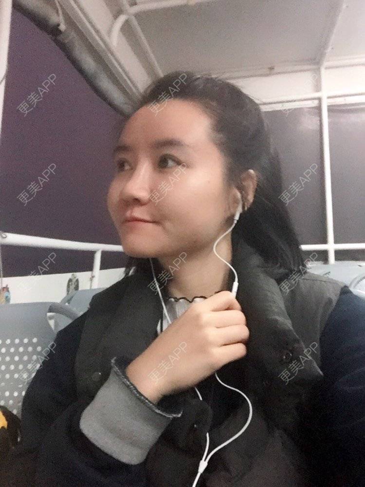 更美 - fhrhjtjth的近视矫正经验 | 深圳 | 近视矫正