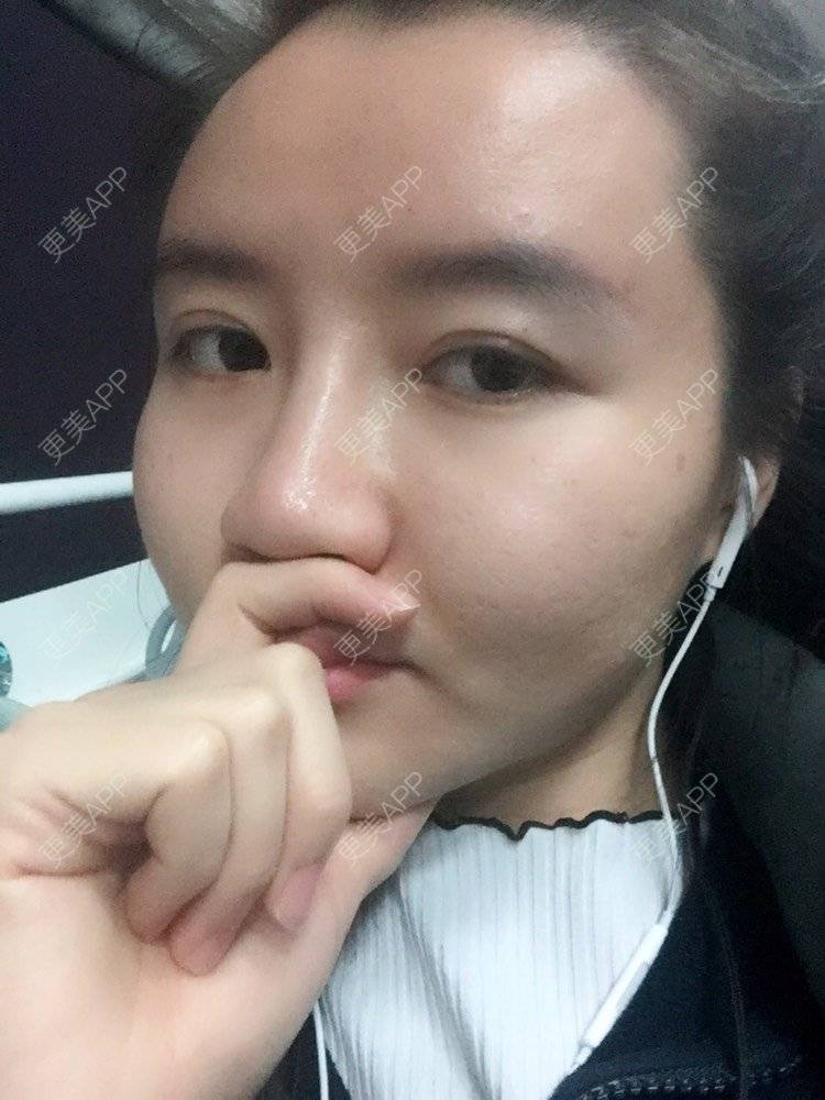 更美 - fhrhjtjth的近视矫正经验 | 深圳 | 近视矫正