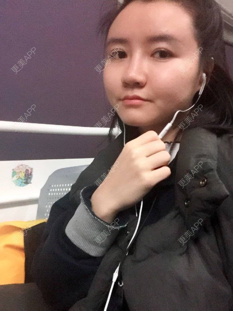 更美 - fhrhjtjth的近视矫正经验 | 深圳 | 近视矫正