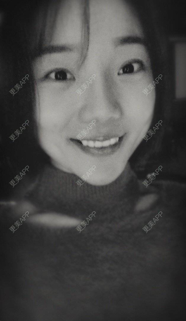 更美 - 更美用户HktsdssB56的牙贴面经验 | 成都 | 牙贴面 | 牙齿瓷贴面