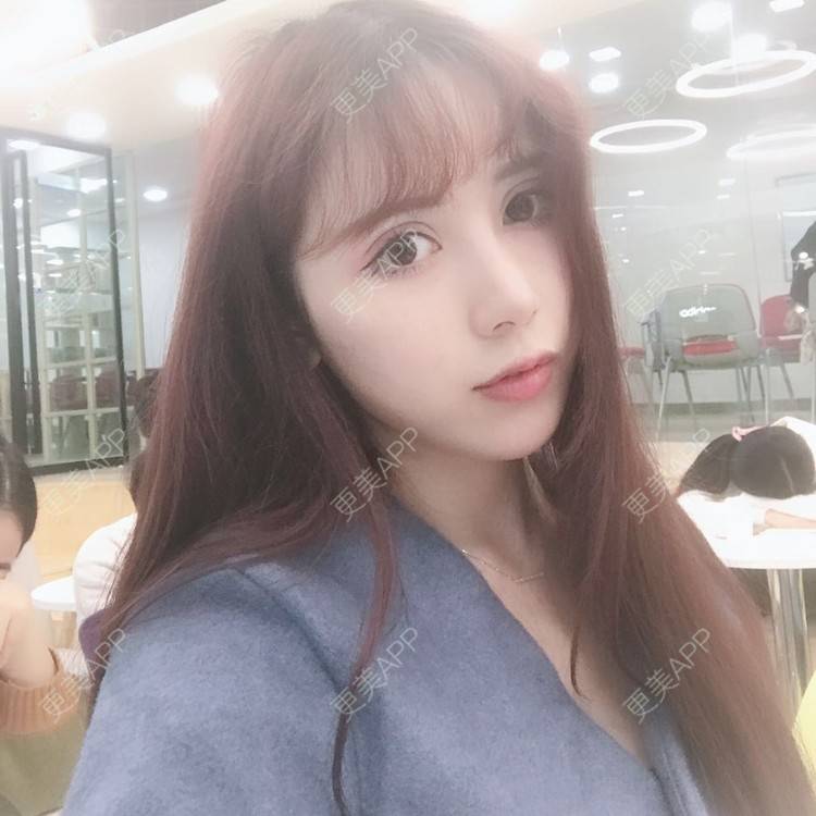 更美 - 更美用户HzCxtYeP3y的胶原蛋白丰面颊经验 | 胶原蛋白丰面颊 | 玻尿酸