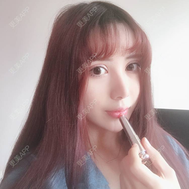 更美 - 更美用户HzCxtYeP3y的胶原蛋白丰面颊经验 | 胶原蛋白丰面颊 | 玻尿酸