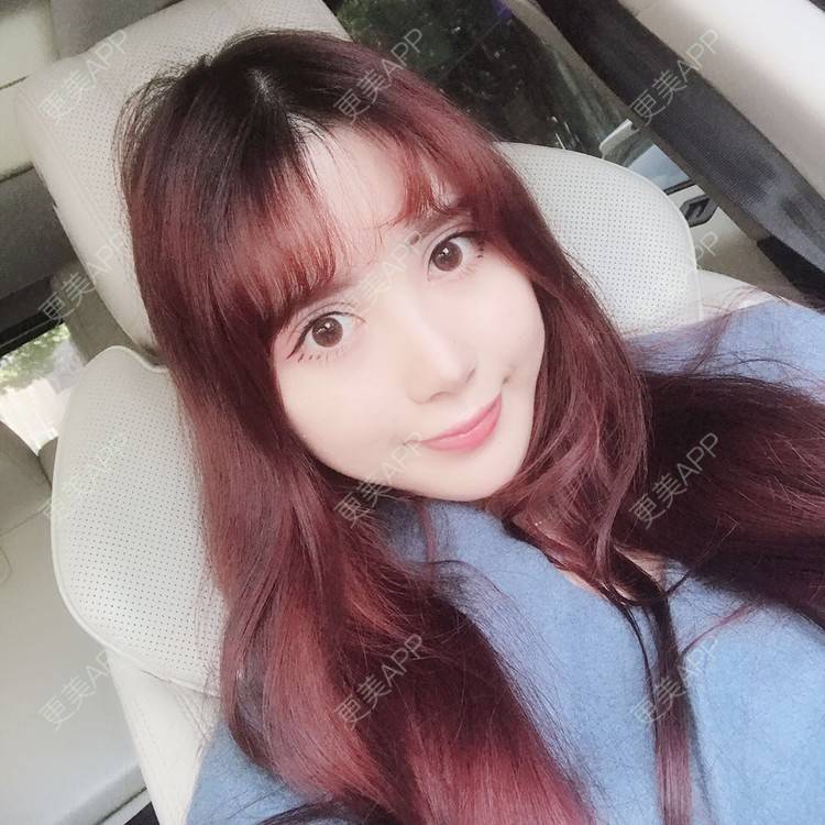 更美 - 更美用户HzCxtYeP3y的胶原蛋白丰面颊经验 | 胶原蛋白丰面颊 | 玻尿酸