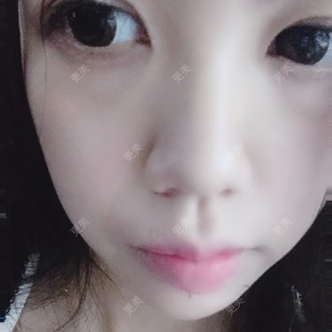 胶原蛋白丰面颊