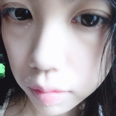 胶原蛋白丰面颊