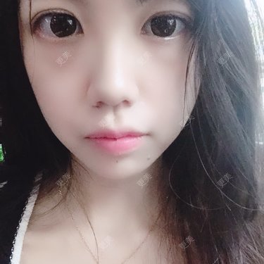 胶原蛋白丰面颊
