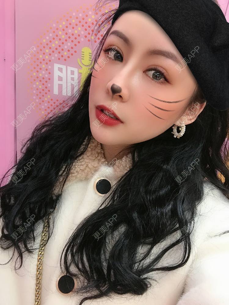更美 - 卡门小妖精，的玻尿酸卧蚕经验 | 玻尿酸卧蚕 | 重庆 | 自体脂肪丰卧蚕 | 真皮丰卧蚕 | 双眼皮修复 | 眼部多项