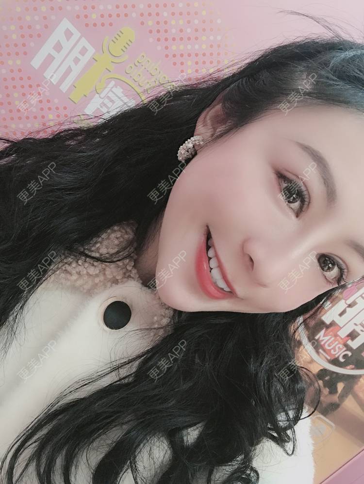 更美 - 卡门小妖精，的玻尿酸卧蚕经验 | 玻尿酸卧蚕 | 重庆 | 自体脂肪丰卧蚕 | 真皮丰卧蚕 | 双眼皮修复 | 眼部多项