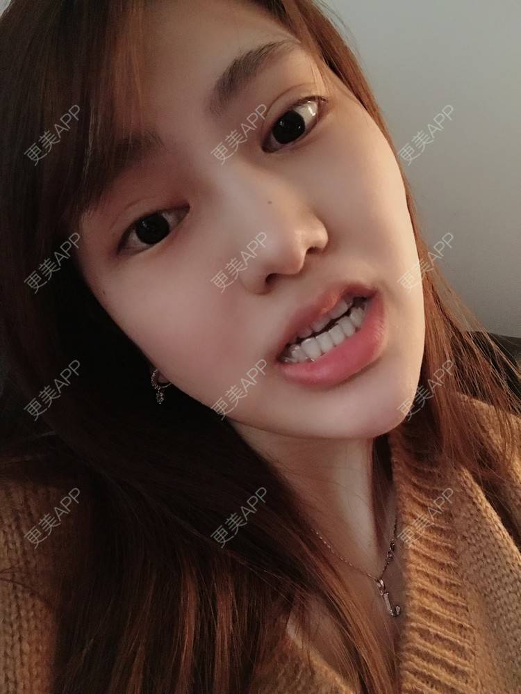 更美 - 更美用户Zxz1XIEMyn的经验 | 上海