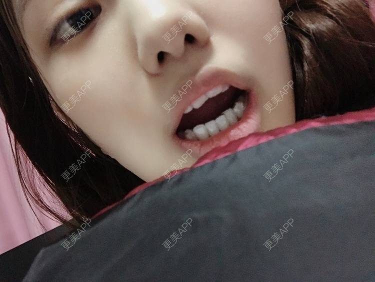 更美 - 更美用户Zxz1XIEMyn的经验 | 上海