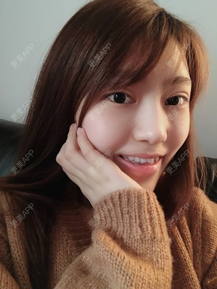 更美 - 更美用户Zxz1XIEMyn的经验 | 上海