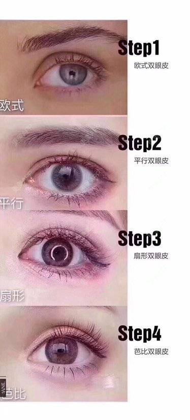 更美 - 祢的美丽/我的职责的全切双眼皮经验 | 全切双眼皮 | 定点双眼皮 | 上海