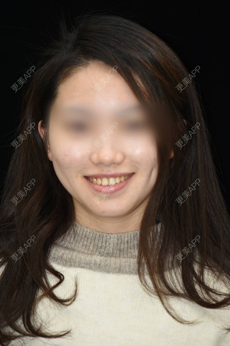 更美 - 更美用户4iLEe1psGi的口腔检查经验 | 口腔检查