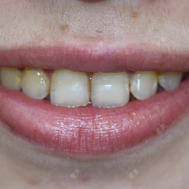 更美用户4iLEe1psGi