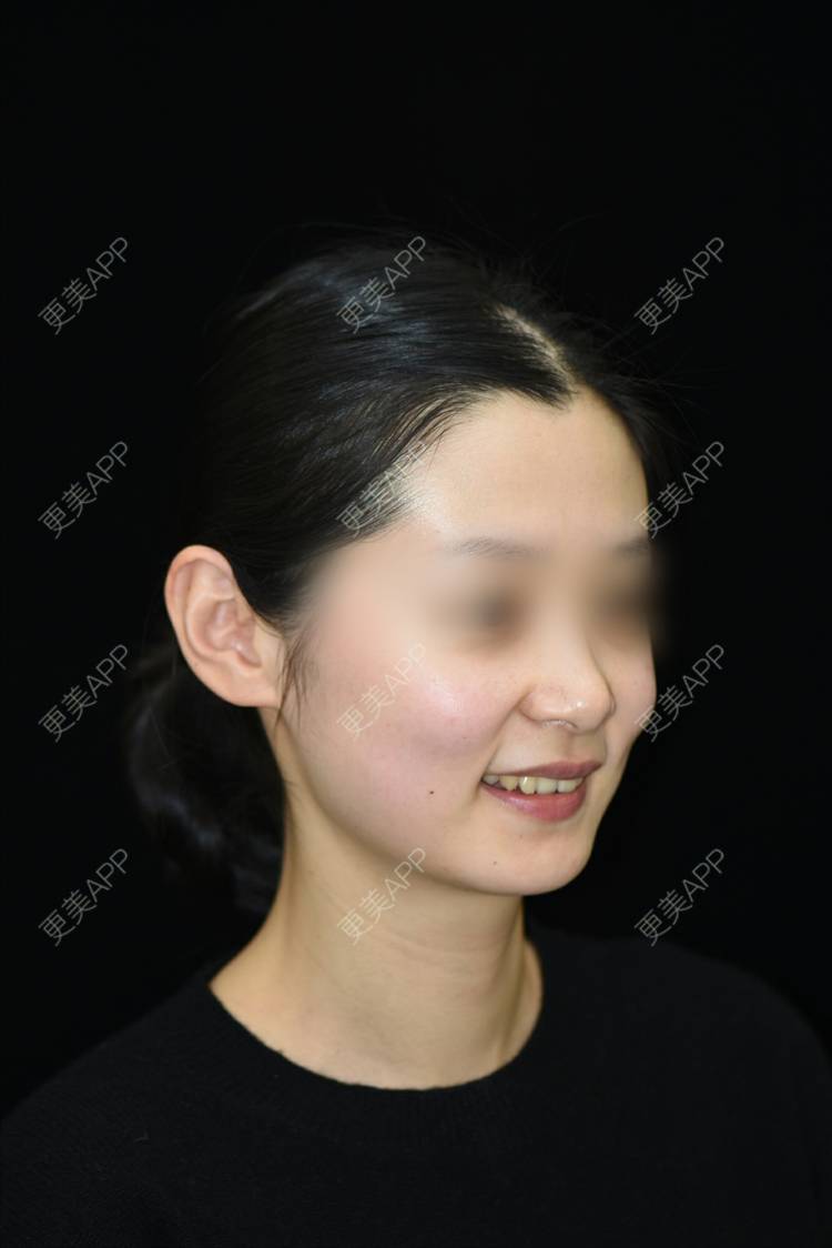 更美 - 更美用户2cJFoLLJL6的口腔检查经验 | 口腔检查