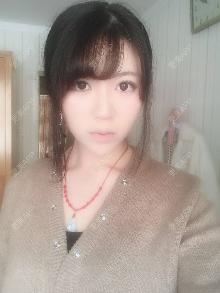 更美 - 张书毓 医生的自体脂肪全面部填充经验 | 自体脂肪全面部填充 | 沈阳 | 视频日记
