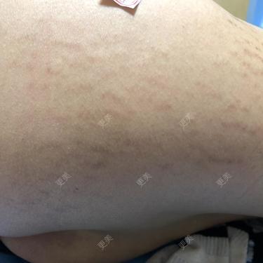 蓝玫瑰与你