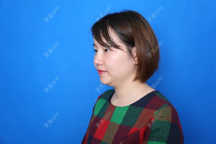 更美 - 猪猪小孩的鼻部修复经验 | 鼻部修复 | 注射溶脂瘦脸 | 双下巴溶脂 | 南宁