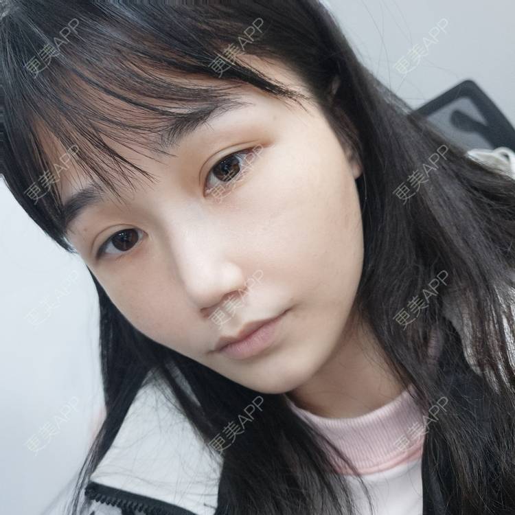 更美 - Rosebush20的水光项目经验 | 更美研究所 | 水光项目 | 光子嫩肤 | 南宁