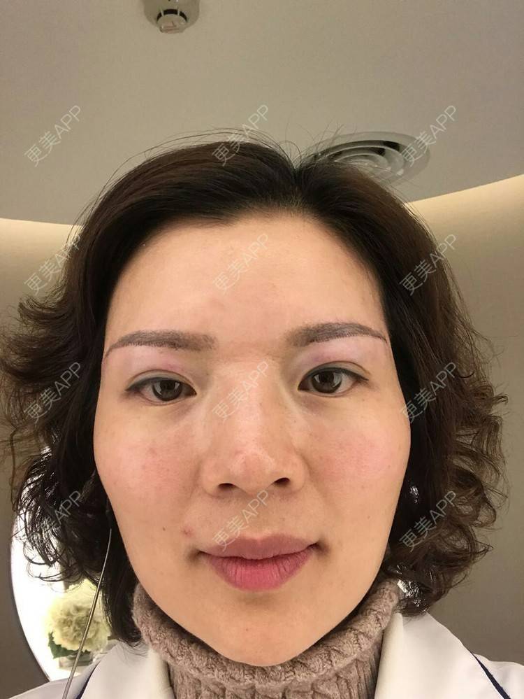 更美 - 雪之精灵的切眉经验 | 切眉 | 成都