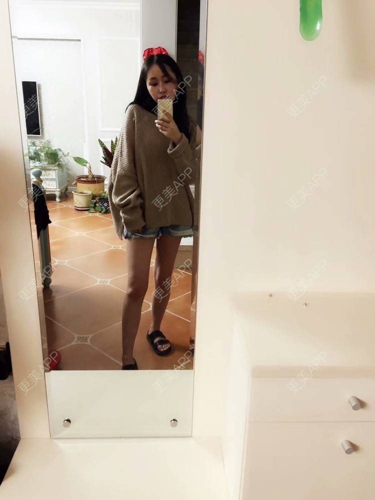 张小花花花的吸脂瘦大腿日记