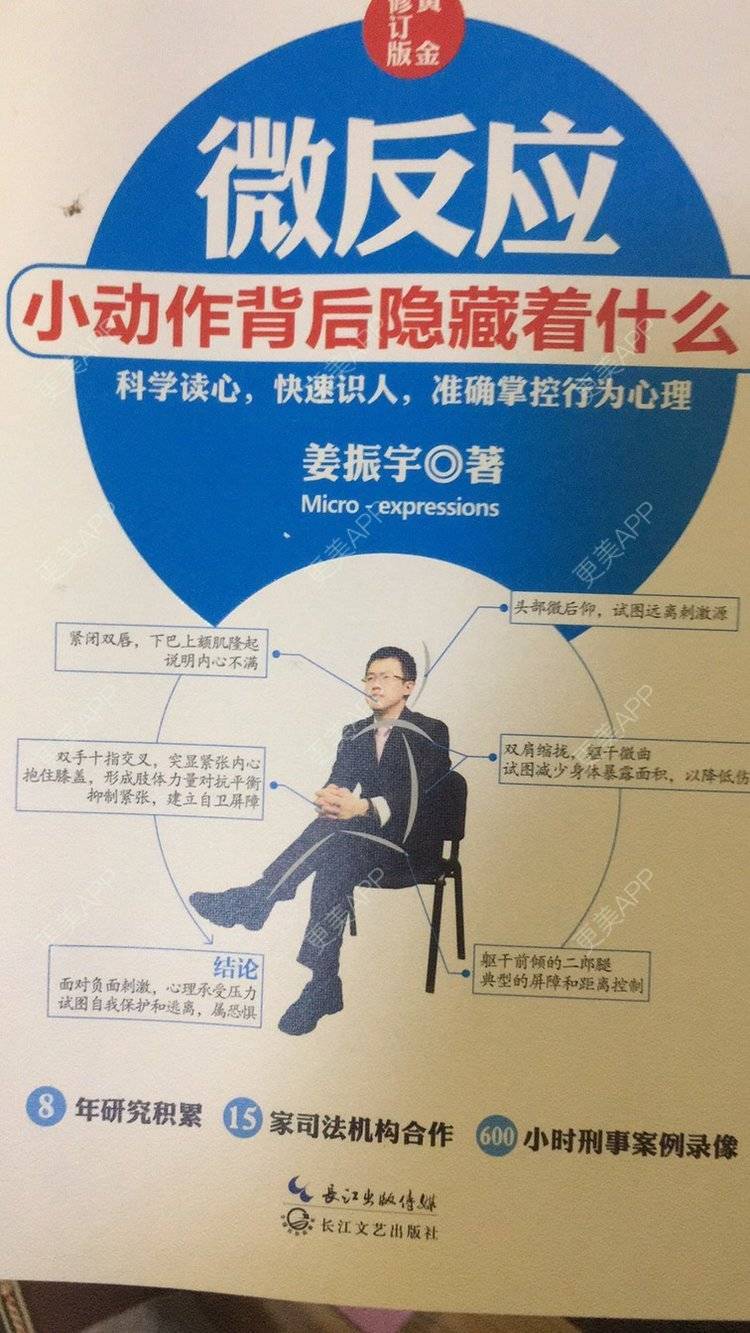 更美 - 8级大狂风。的颧骨提高经验 | 颧骨提高 | 成都