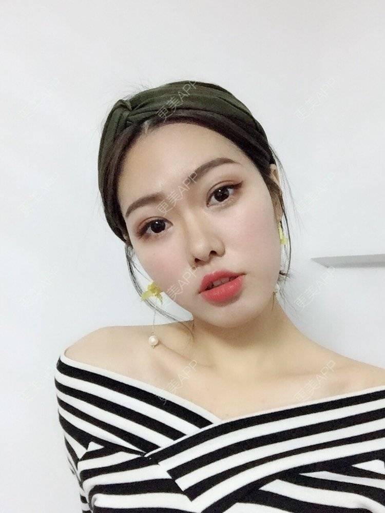 更美 - 杨连华 医生的内切去眼袋经验 | 视频日记 | 内切去眼袋 | 外切去眼袋 | 更美研究所