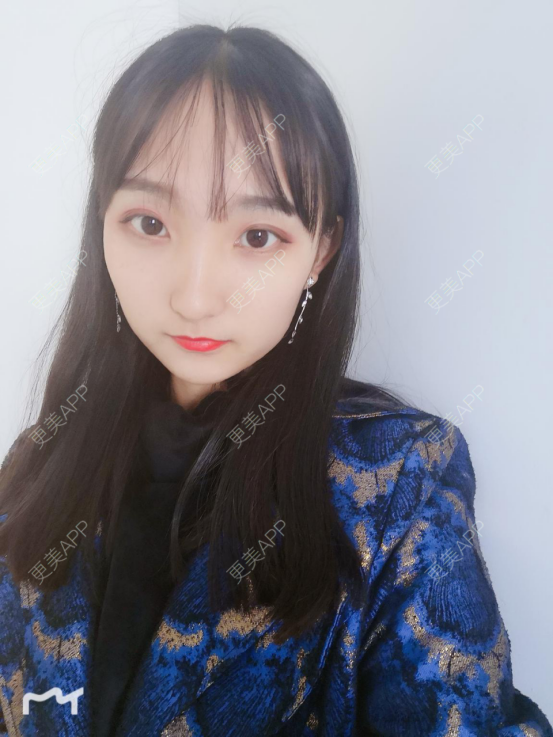 更美 - 银川田永成医学美容有限责任公司田永成医学美容门诊部的祛眼袋经验 | 祛眼袋