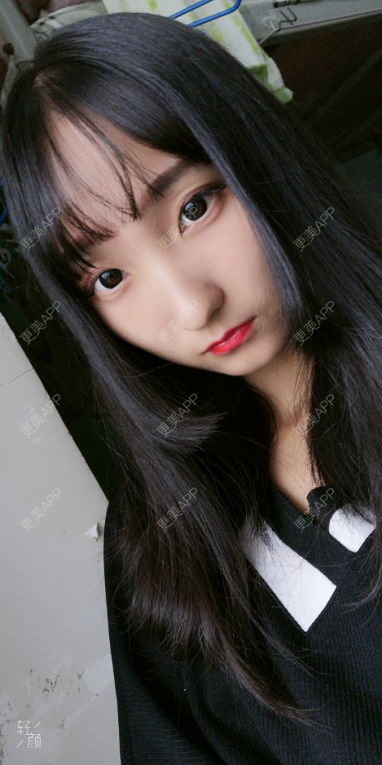 更美 - 银川田永成医学美容有限责任公司田永成医学美容门诊部的祛眼袋经验 | 祛眼袋