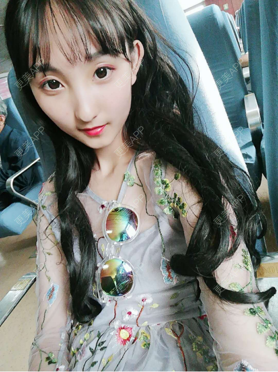 更美 - 银川田永成医学美容有限责任公司田永成医学美容门诊部的祛眼袋经验 | 祛眼袋