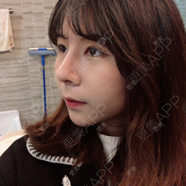 看到你就逃