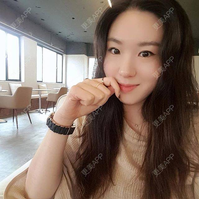 更美 - 更美用户fiCYLdqaPX的针灸减肥经验 | 针灸减肥