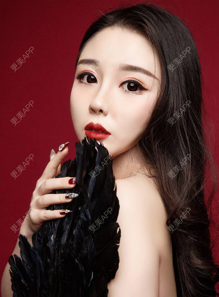 更美 - 更美用户RMdGuoidr7的双下巴吸脂经验 | 双下巴吸脂 | 沈阳