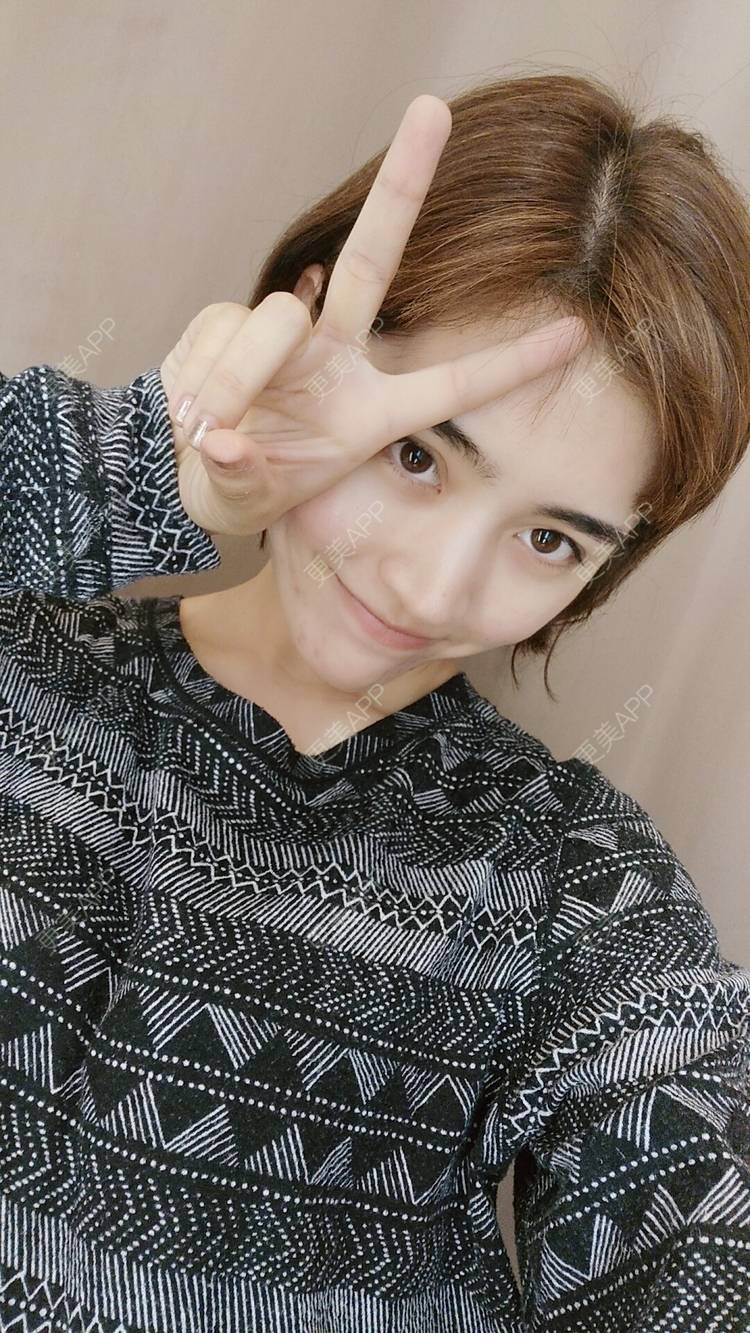 更美 - 更美用户6rYvOEJ1HO的驼峰鼻矫正经验 | 视频日记 | 驼峰鼻矫正