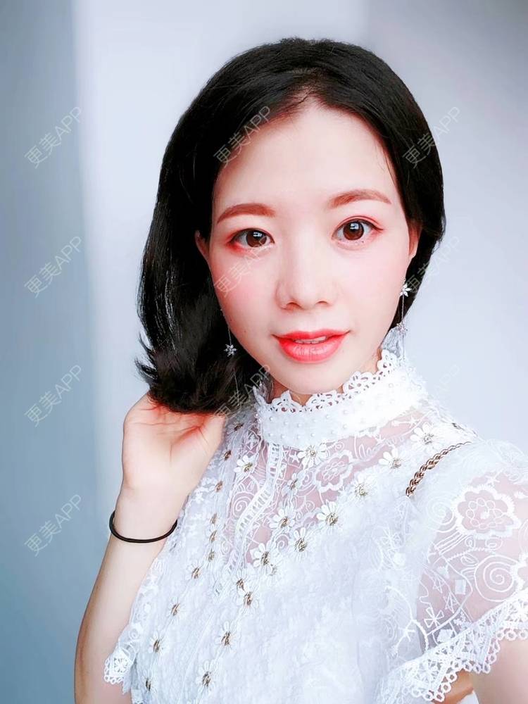 更美 - 更美用户1uRzE9prdE的激光去眼袋经验 | 激光去眼袋 | 广州