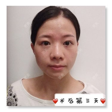 更美用户1uRzE9prdE