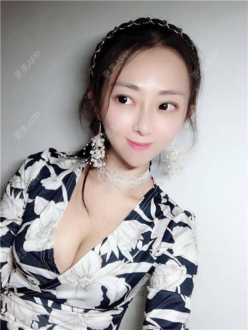 更美 - 花花小可爱的自体脂肪隆胸经验 | 自体脂肪隆胸 | 广州