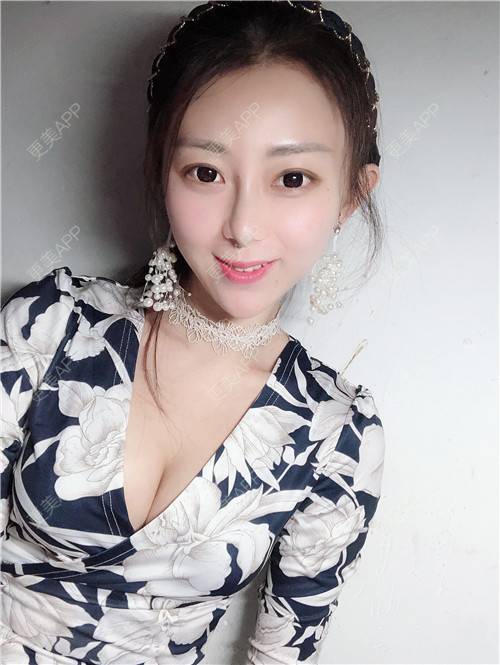 更美 - 花花小可爱的自体脂肪隆胸经验 | 自体脂肪隆胸 | 广州
