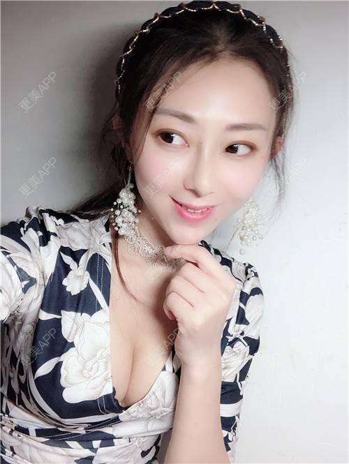 更美 - 花花小可爱的自体脂肪隆胸经验 | 自体脂肪隆胸 | 广州