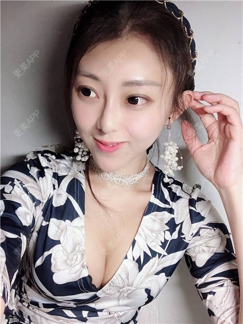 更美 - 花花小可爱的自体脂肪隆胸经验 | 自体脂肪隆胸 | 广州